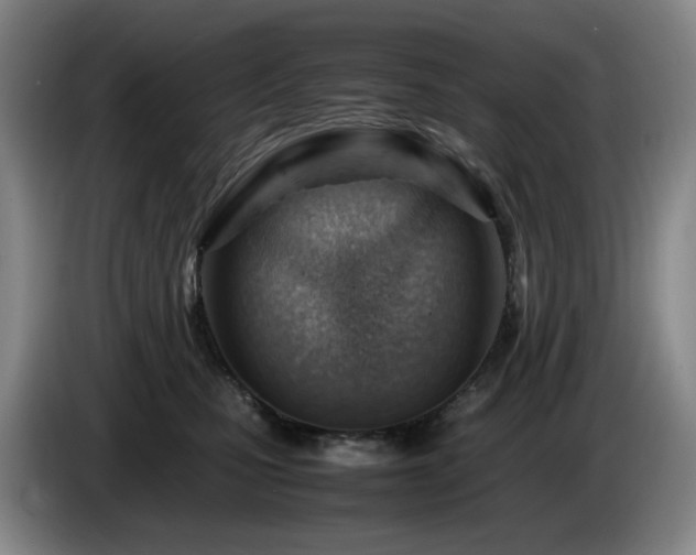 X0000085210471200703091142