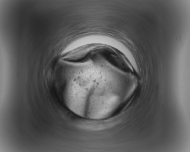 X0000085210029200703301651