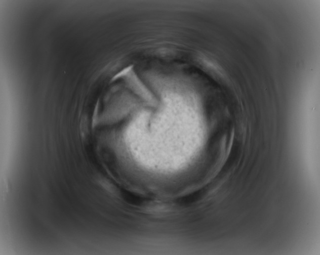 X0000085210077200703301651