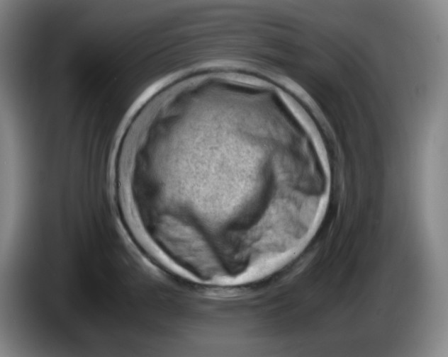 X0000085211199200703301635