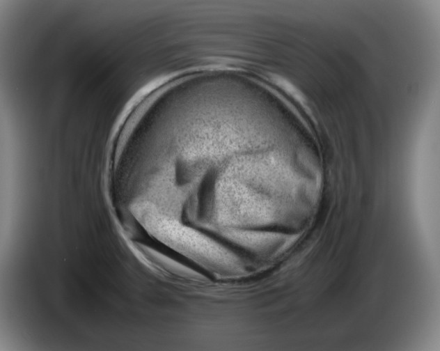 X0000085211379200703301632