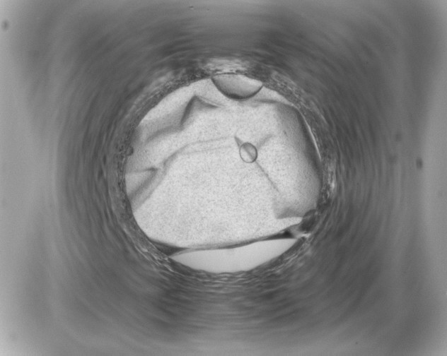 X0000085211393200704091854