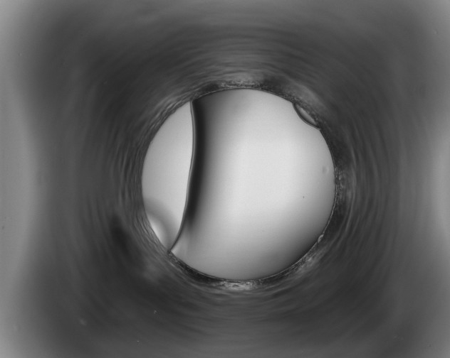 X0000085220143200703090836