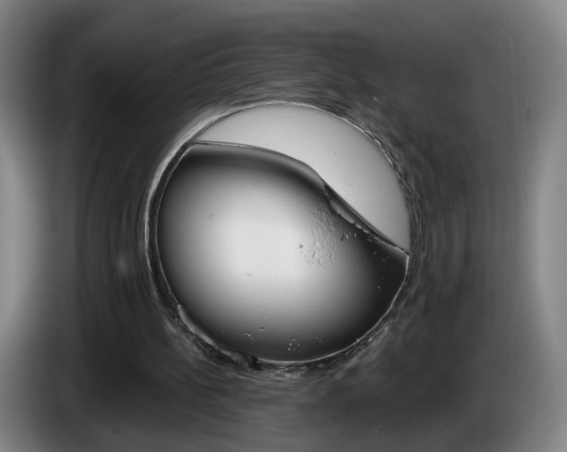 X0000085220148200703090835