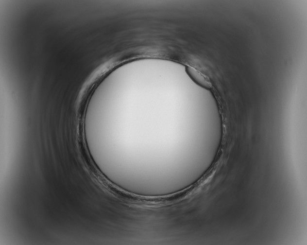 X0000085220149200703090835