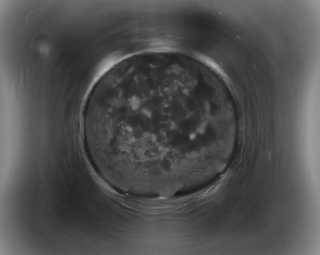 X0000085221467200703091149