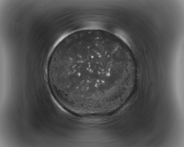 X0000085221468200703091149