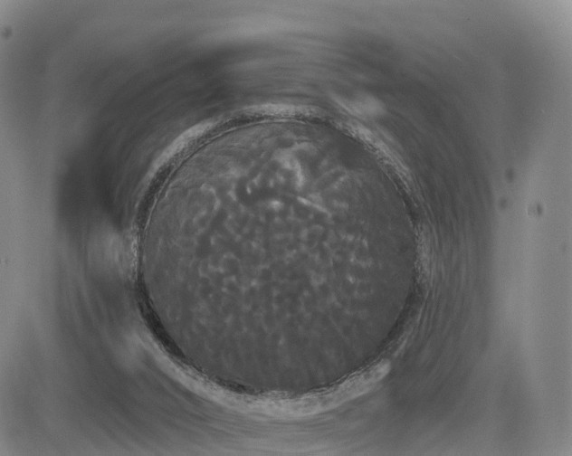 X0000085220016200703161256
