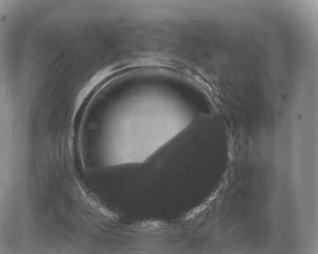 X0000085220152200703161253
