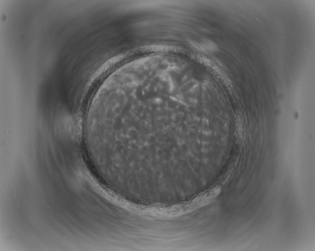 X0000085220016200703231544