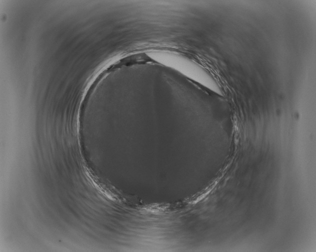 X0000085220148200703231541