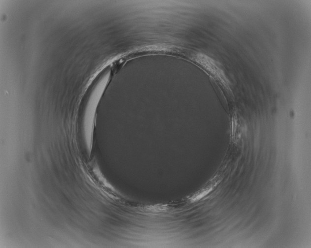 X0000085220156200703231542