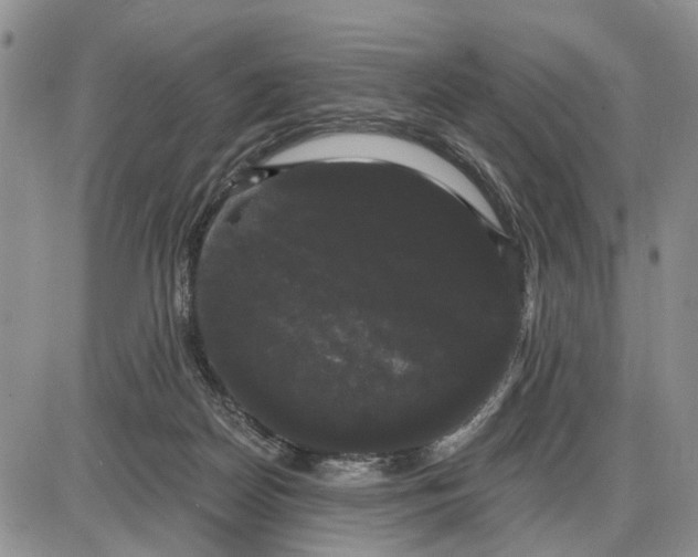 X0000085220170200703231542