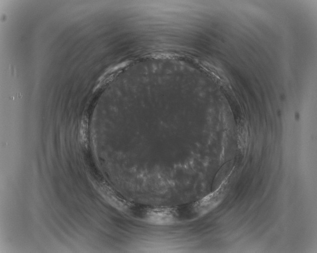 X0000085220175200703231542