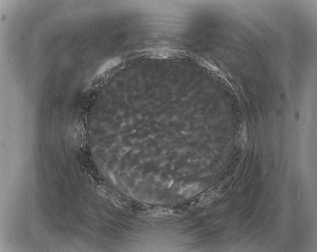 X0000085221446200703231520