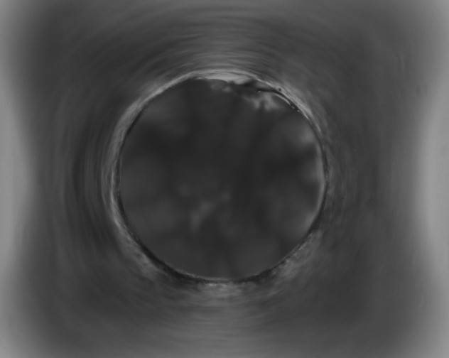 X0000085220145200703301711