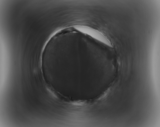 X0000085220148200703301711