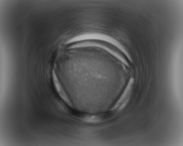 X0000085220174200703301711