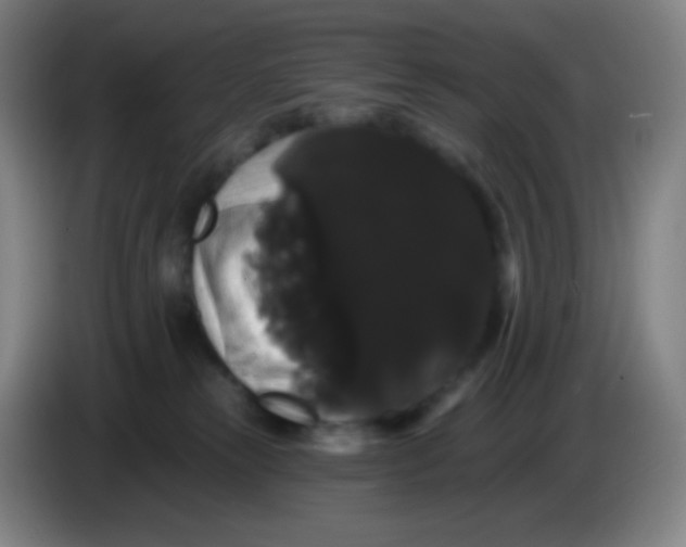 X0000085220181200703301711