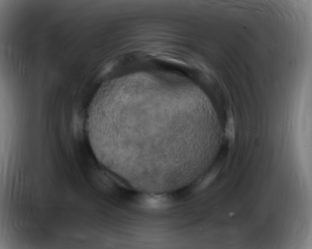 X0000085220333200703301709