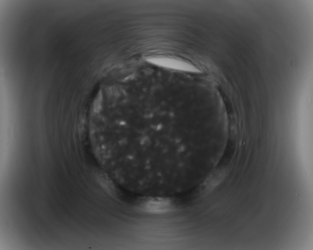 X0000085220369200703301708