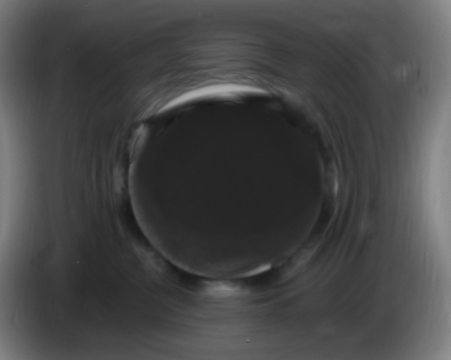 X0000085220380200703301708