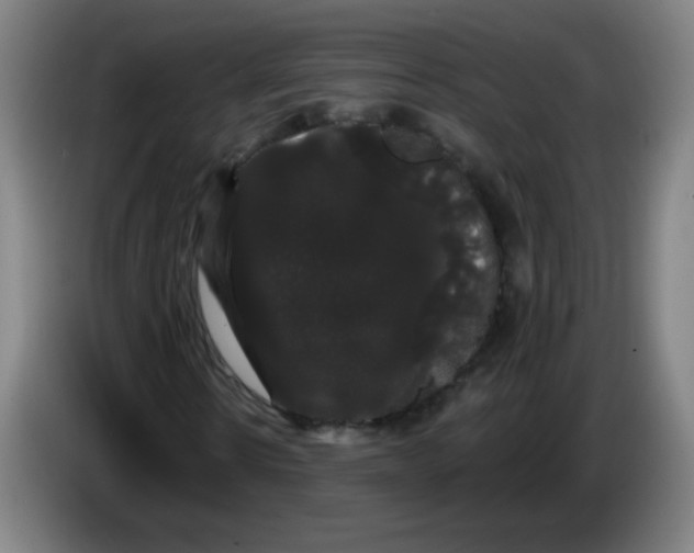 X0000085220914200703301700