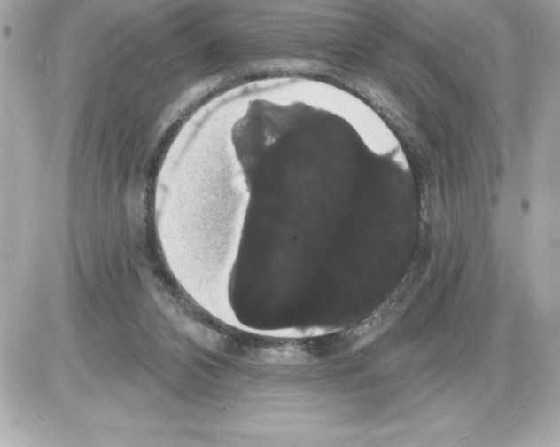 X0000085220112200704091942