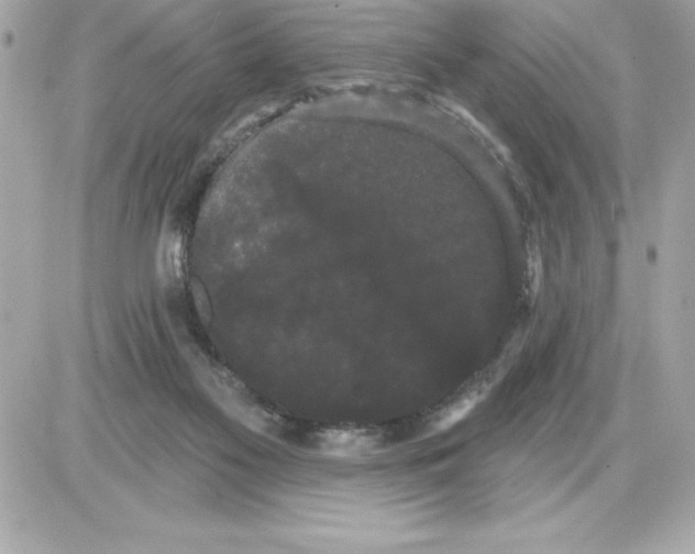 X0000085220117200704091942