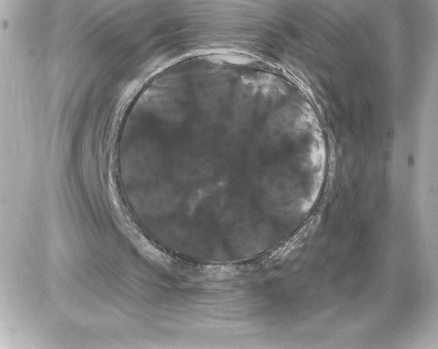 X0000085220145200704091940