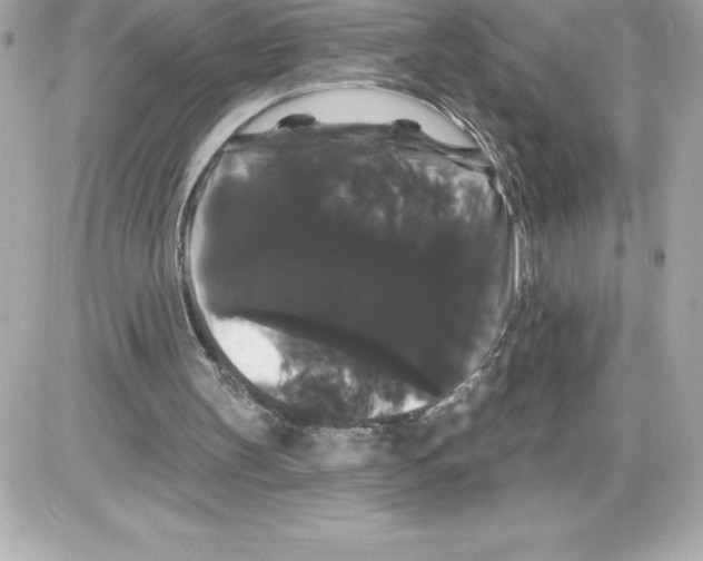 X0000085220147200704091940