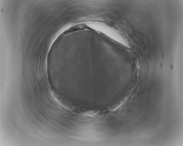 X0000085220148200704091940