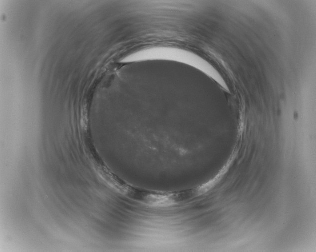 X0000085220170200704091941