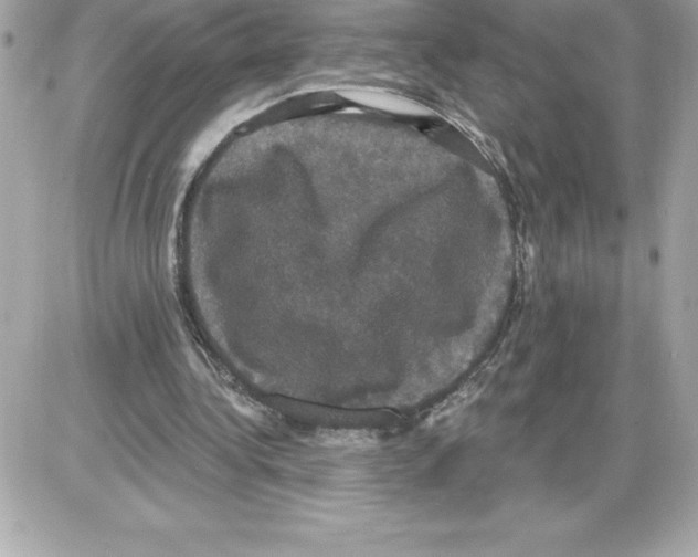 X0000085220340200704091937