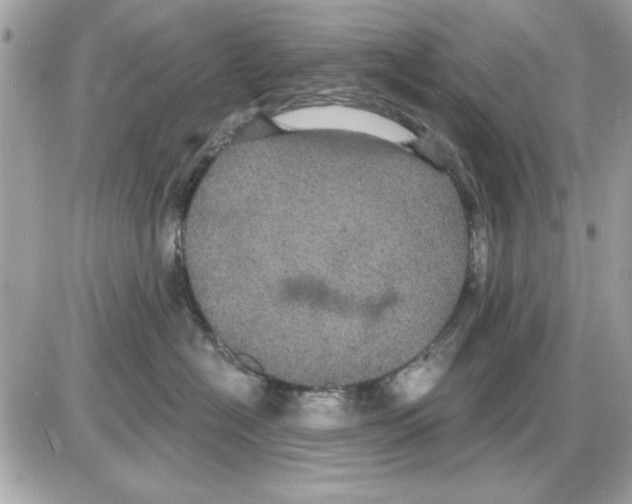 X0000085220574200704091935