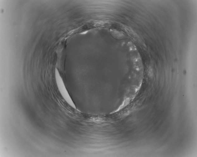 X0000085220914200704091928