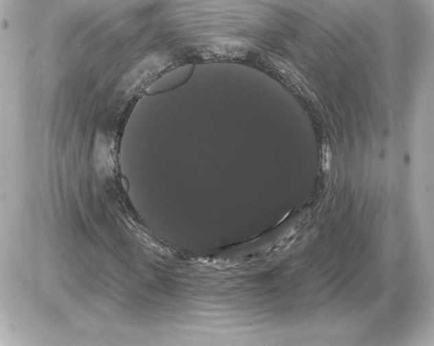 X0000085220915200704091928