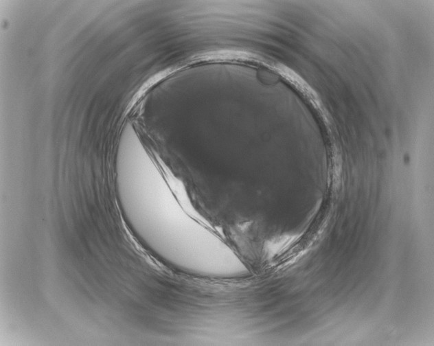 X0000085220945200704091928