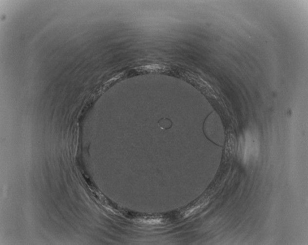 X0000085230651200703161311