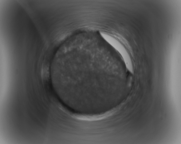 X0000085230017200703301735