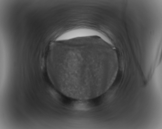 X0000085230077200703301735