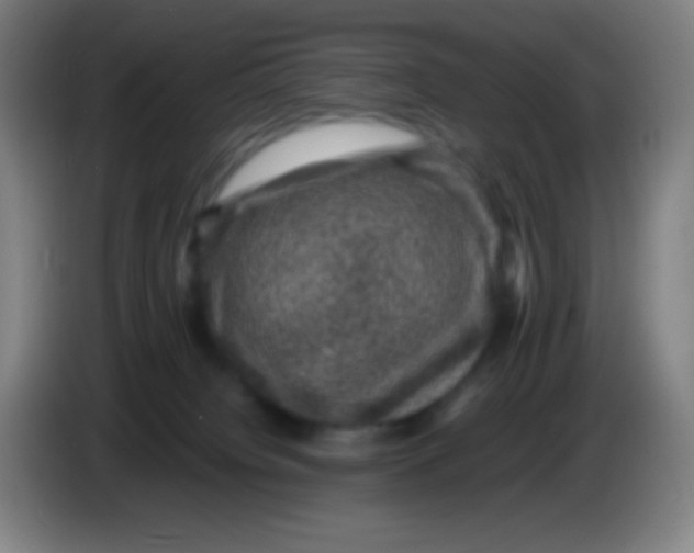 X0000085230084200703301735