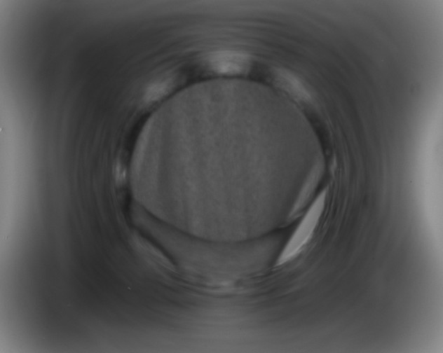 X0000085230176200703301733