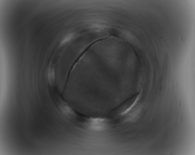 X0000085230192200703301733