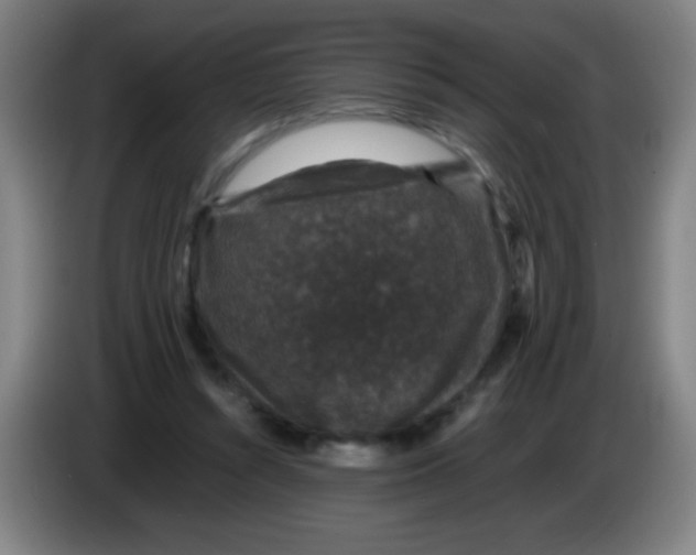X0000085230352200703301730