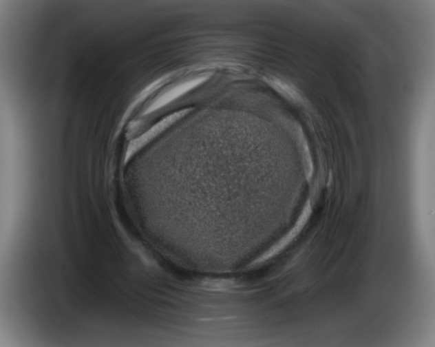 X0000085230440200703301729