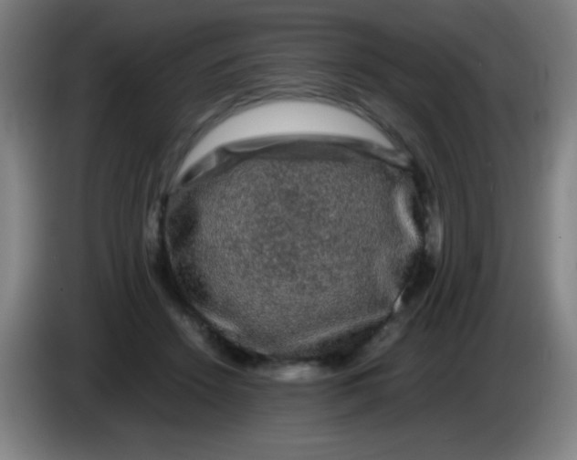 X0000085230456200703301729