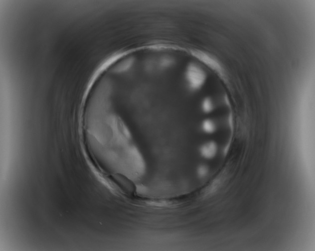 X0000085231231200703301718