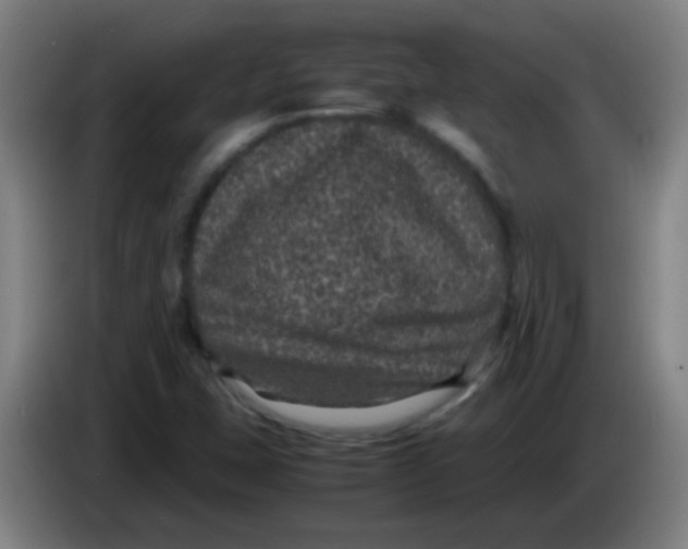 X0000085231407200703301715