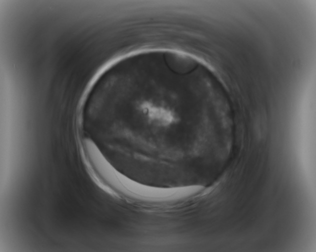 X0000085231519200703301714